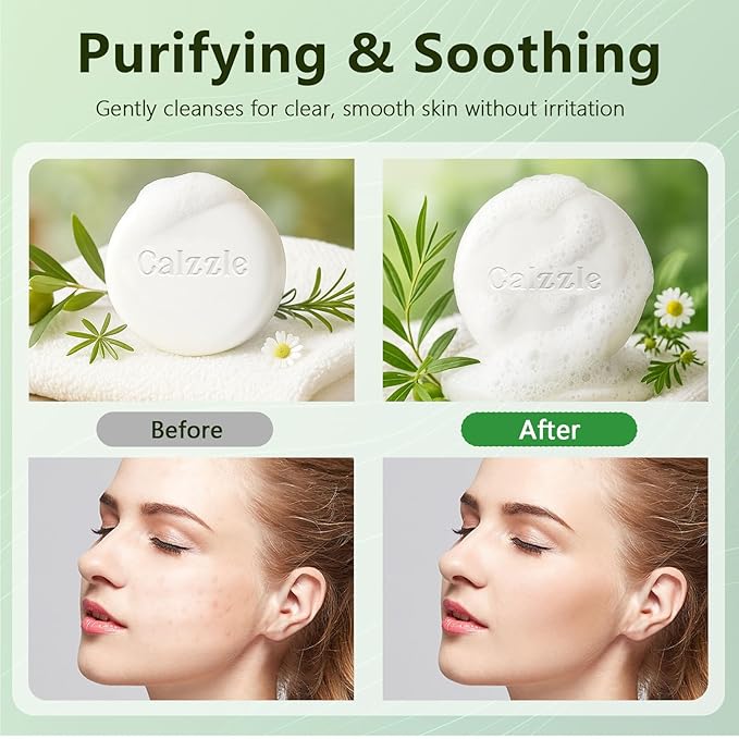 4 Pcs Herbal Soap Bar with Tea Tree Oil, Olive Oil & Organic Shea Butter - Natural Handmade Soap for Women & Men, Gentle Face, Body & Foot Cleanser for Dry, Itchy or Sensitive Skin, 3.53 oz