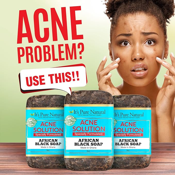 It's Pure Natural African Black Soap Bars with Acne Solution (Pack of 3) Organic Raw Soap for Face & Body, Acne Treatment & Dark Spot Remover [Made in Ghana]